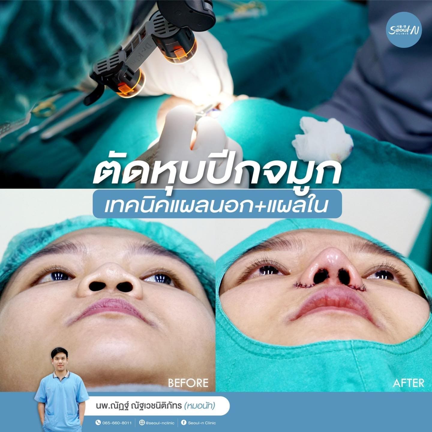 รวมทรงจมูกยอดฮิต