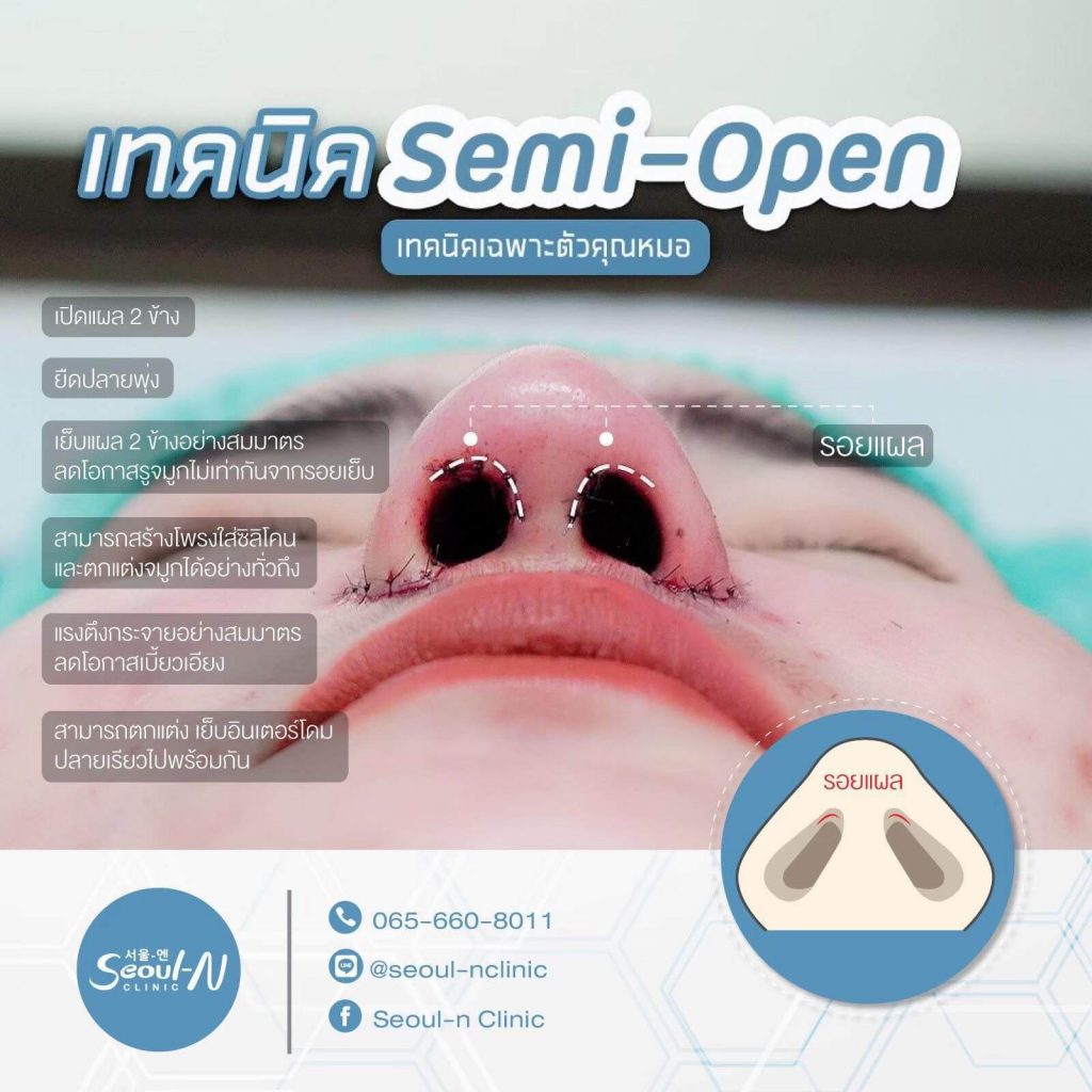 เทคนิค Semi Open