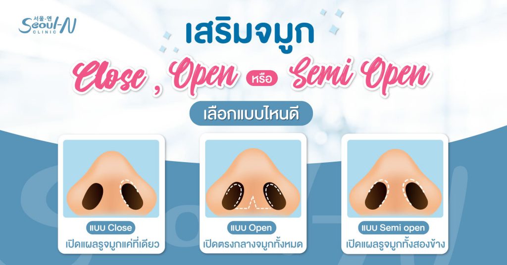 เสริมจมูก Close Open และ Semi Open