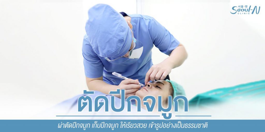 ผ่าตัดปีกจมูก