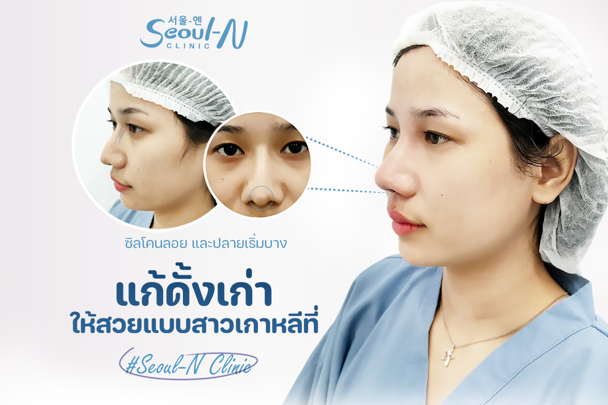 แก้จมูก ทรงเกาหลี ที่ Seoul-N Clinic