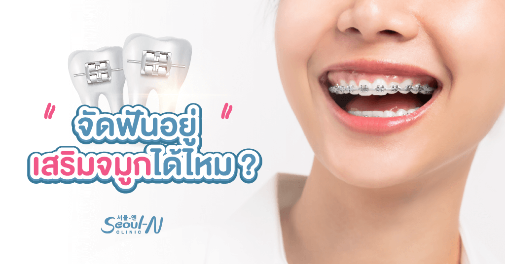 จัดฟันอยู่ เสริมจมูกได้ไหม ?