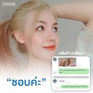 รีวิวเสริมจมูก Seoul N Clinic