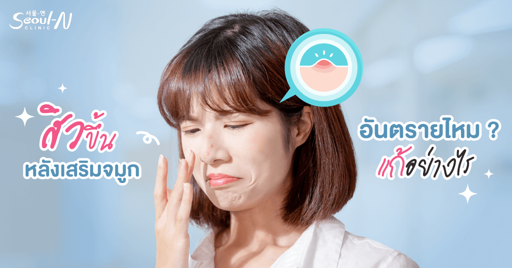 สิวขึ้นหลังเสริมจมูก อันตรายไหม ?